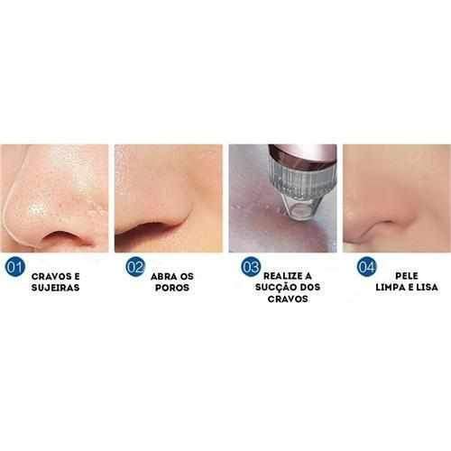 Vacuum Blackhead Remover - PoreCleaner